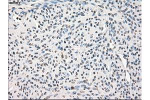 Immunohistochemical staining of paraffin-embedded pancreas tissue using anti-LTA4Hmouse monoclonal antibody. (LTA4H anticorps)