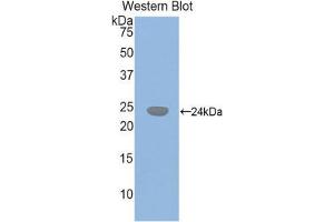 Western Blotting (WB) image for anti-Glutathione Synthetase (GSS) (AA 270-474) antibody (ABIN1859086)
