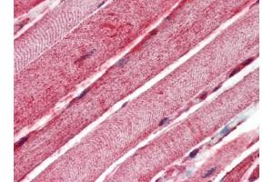 Human Skeletal Muscle (formalin-fixed, paraffin-embedded) stained with BAK1at 10 µg/ml followed by biotinylated goat anti-rabbit IgG secondary antibody, alkaline phosphatase-streptavidin and chromogen. (BAK1 anticorps  (N-Term))
