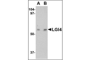 Western blot analysis of LGI4 in human brain tissue lysate with this product at (A) 1 and (B) 2 μg/ml. (LGI4 anticorps  (Center))