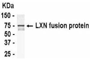 Western Blotting (WB) image for anti-Latexin (LXN) (AA 1-222) antibody (ABIN2467857) (Latexin anticorps  (AA 1-222))