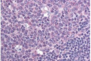 Human Tonsil (formalin-fixed, paraffin-embedded) stained with CXCR7 antibody ABIN295878 at 10 ug/ml followed by biotinylated goat anti-rabbit IgG secondary antibody ABIN481713, alkaline phosphatase-streptavidin and chromogen. (CXCR7 anticorps  (AA 100-150))