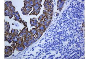 Image no. 6 for anti-Keratin 5 (KRT5) (AA 1-273) antibody (ABIN1490696)