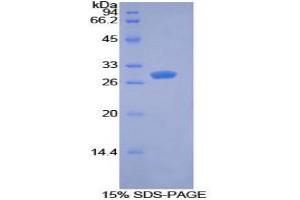 SDS-PAGE analysis of Mouse PDK1 Protein. (PDK1 Protéine)
