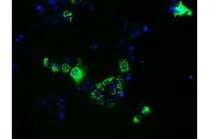 Immunofluorescence (IF) image for anti-Fumarylacetoacetate Hydrolase Domain Containing 2A (FAHD2A) antibody (ABIN1498181) (FAHD2A anticorps)