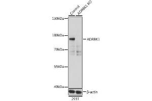 Western blot analysis of extracts from normal (control) and ADRBK1 knockout (KO) 293T cells using ADRBK1 Polyclonal Antibody at dilution of 1:500. (GRK2 anticorps)