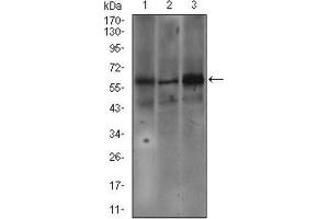 Western Blotting (WB) image for anti-Fc Fragment of IgE Receptor Ia (FCER1A) (AA 42-103) antibody (ABIN1845339) (Fc epsilon RI/FCER1A anticorps  (AA 42-103))