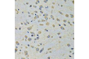 Immunohistochemistry of paraffin-embedded rat brain using DARS antibody.