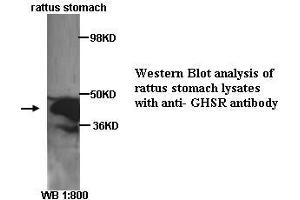 Image no. 1 for anti-Growth Hormone Secretagogue Receptor (GHSR) (C-Term) antibody (ABIN790871) (GHSR anticorps  (C-Term))