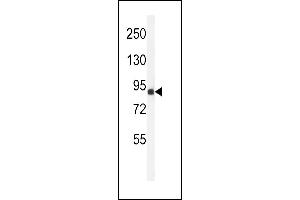 Western blot analysis of ANR49 Antibody (Center) (ABIN651157 and ABIN2840103) in Jurkat cell line lysates (35 μg/lane). (ANKRD49 anticorps  (AA 80-109))