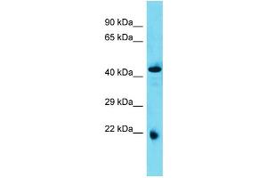 Host: Rabbit  Target Name: Abhd4  Sample Tissue: Rat Pancreas lysates  Antibody Dilution: 1. (ABHD4 anticorps  (N-Term))