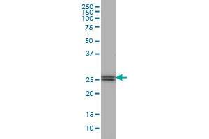 PHOSPHO1 monoclonal antibody (M04), clone 4B2 Western Blot analysis of PHOSPHO1 expression in Jurkat .