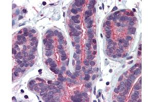 Anti-RHOA antibody IHC of human breast. (RHOA anticorps  (AA 1-194))