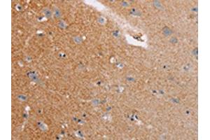The image on the left is immunohistochemistry of paraffin-embedded Human brain tissue using ABIN7128771(CASC3 Antibody) at dilution 1/20, on the right is treated with fusion protein. (CASC3 anticorps)