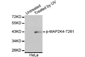 Western blot analysis of extracts of HeLa cells, using Phospho-MAP2K4-T261 antibody (ABIN5995644). (MAP2K4 anticorps  (pThr261))