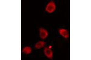 ABIN6274133 staining HeLa cells by IF/ICC. (ZNF265 anticorps  (Internal Region))