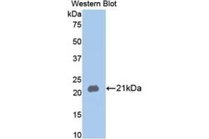 Detection of Recombinant MMP13, Rabbit using Polyclonal Antibody to Matrix Metalloproteinase 13 (MMP13) (MMP13 anticorps  (AA 70-245))