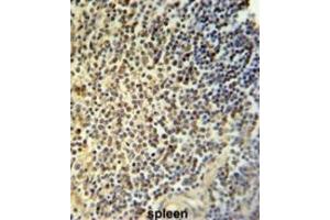 Immunohistochemistry (IHC) image for anti-Nuclear Receptor Subfamily 5, Group A, Member 1 (NR5A1) antibody (ABIN3002239) (NR5A1 anticorps)