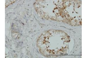 Image no. 3 for anti-A Kinase (PRKA) Anchor Protein 10 (AKAP10) (AA 1-101) antibody (ABIN599175) (AKAP10 anticorps  (AA 1-101))