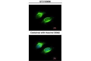 ICC/IF Image Immunofluorescence analysis of methanol-fixed HeLa, using PAPSS1, antibody at 1:200 dilution.