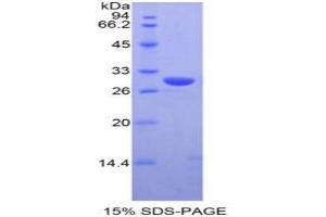 SDS-PAGE of Protein Standard from the Kit (Highly purified E. (Moesin Kit ELISA)