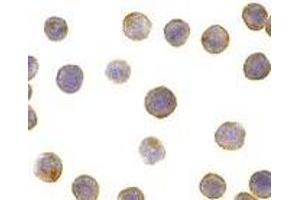 Western blot analysis of DFF45 in HeLa (H), Jurkat (J), A431 (A), and K562 (K) whole cell lysate with anti- DFF45 (CT) at 1ug/ml.