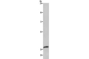 Gel: 6 % SDS-PAGE, Lysate: 40 μg, Lane: Mouse kidney tissue, Primary antibody: ABIN7129587(GDF3 Antibody) at dilution 1/250, Secondary antibody: Goat anti rabbit IgG at 1/8000 dilution, Exposure time: 1 minute (GDF3 anticorps)