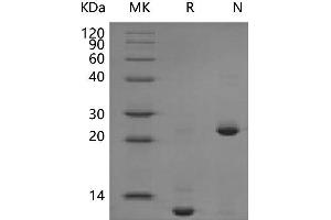 Western Blotting (WB) image for Transforming Growth Factor, beta 2 (TGFB2) (Active) protein (ABIN7320669) (TGFB2 Protéine)