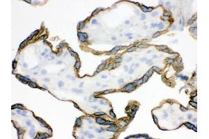 IHC analysis of ZP2 using anti-ZP2 antibody .