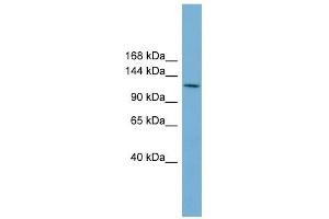 CDC27 antibody used at 1 ug/ml to detect target protein. (CDC27 anticorps)
