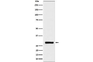 Western blot analysis of BRMS1 expression in HeLa cell lysate.