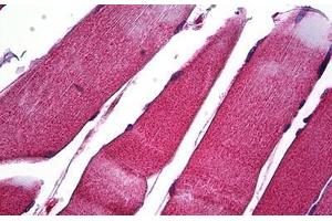 Human Skeletal Muscle: Formalin-Fixed, Paraffin-Embedded (FFPE) (MMP1 anticorps  (C-Term))