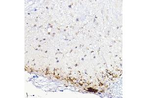 Immunohistochemistry of paraffin-embedded mouse spinal cord using CALCA Rabbit pAb (ABIN7266005) at dilution of 1:100 (40x lens).