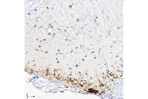 Immunohistochemistry of paraffin-embedded mouse spinal cord using CALCA Rabbit pAb (ABIN7266005) at dilution of 1:100 (40x lens). (CGRP anticorps  (AA 1-141))