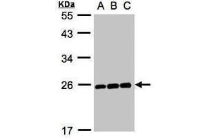 WB Image Sample (30μg whole cell lysate) A:Hep G2 , B:MOLT4 , C:Raji , 12% SDS PAGE antibody diluted at 1:1000