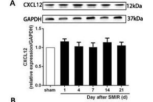 The CXCR7 and PI3K/Akt signaling pathways are involved in CPSP in the dorsal horn of the spinal cord. (GAPDH anticorps)