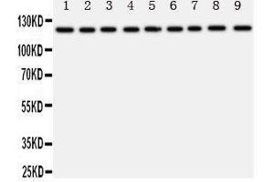 Western Blotting (WB) image for anti-Transient Receptor Potential Cation Channel, Subfamily C, Member 3 (TRPC3) (AA 836-851), (C-Term) antibody (ABIN3044145) (TRPC3 anticorps  (C-Term))