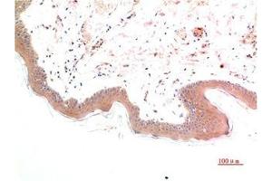Immunohistochemical analysis of paraffin-embedded Human Skin Tissue using Phospho-Smad3(S425) Mouse mAb diluted at 1:200.
