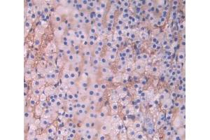 Used in DAB staining on fromalin fixed paraffin- embedded adrenal gland tissue (CYP17A1 anticorps  (AA 183-508))