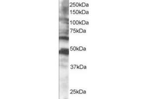 Image no. 1 for anti-Cytoplasmic Polyadenylation Element Binding Protein 1 (CPEB1) (C-Term) antibody (ABIN374439) (CPEB1 anticorps  (C-Term))
