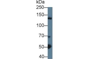 Western blot analysis of Mouse Cerebrum lysate, using Mouse HDAC4 Antibody (1 µg/ml) and HRP-conjugated Goat Anti-Rabbit antibody ( (HDAC4 anticorps  (AA 904-1076))