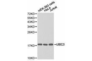 Western Blotting (WB) image for anti-Ubiquitin-Conjugating Enzyme E2I (UBE2I) antibody (ABIN1875255) (UBE2I anticorps)