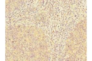 Immunohistochemistry of paraffin-embedded human tonsil tissue using ABIN7173532 at dilution of 1:100 (ADAT1 anticorps  (AA 1-501))