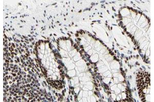 ABIN6266668 at 1/100 staining human colon tissue sections by IHC-P. (UBA2 anticorps  (C-Term))