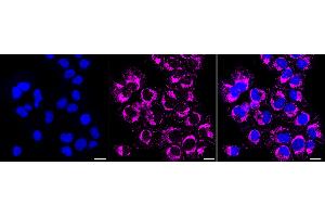 anti-Pyrimidinergic Receptor P2Y, G-Protein Coupled, 6 (P2RY6) antibody