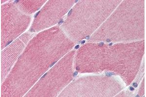 Human Skeletal Muscle (formalin-fixed, paraffin-embedded) stained with PTPN11 antibody ABIN214466 at 5 ug/ml followed by biotinylated goat anti-rabbit IgG secondary antibody ABIN481713, alkaline phosphatase-streptavidin and chromogen. (PTPN11 anticorps  (N-Term))