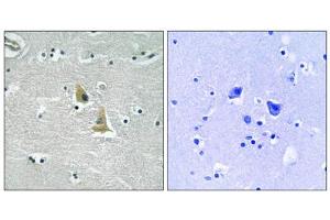 Immunohistochemistry analysis of paraffin-embedded human brain tissue, using p47 phox (epitope around residue 345) antibody. (NCF1 anticorps  (Ser345))