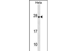 ZT4 Antibody (N-term) (ABIN1538915 and ABIN2849800) western blot analysis in Hela cell line lysates (35 μg/lane). (ZMAT4 anticorps  (N-Term))