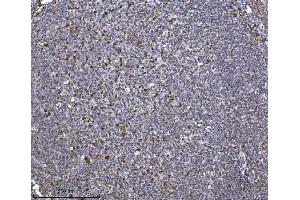 IHC analysis of SCA2/ATXN2 using anti-SCA2/ATXN2 antibody (ABIN7599900). (Ataxin 2 anticorps  (AA 1278-1313))