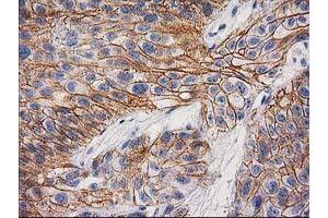 Image no. 1 for anti-Catenin (Cadherin-Associated Protein), beta 1, 88kDa (CTNNB1) antibody (ABIN1496894)